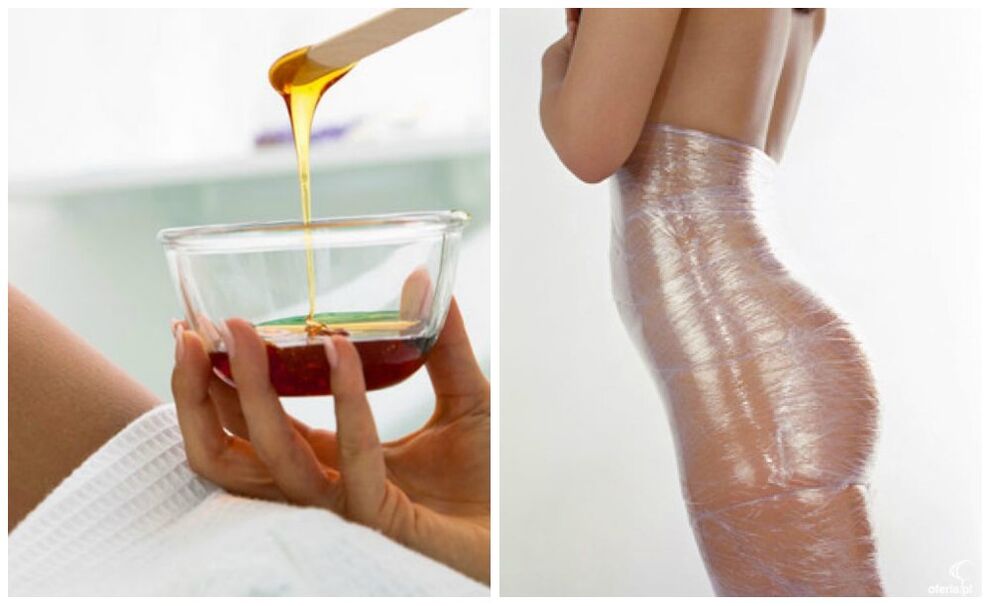 Envolturas corporales para bajar de peso.